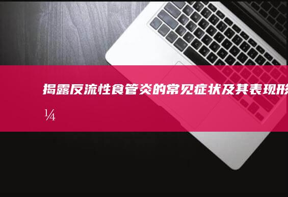 揭露反流性食管炎的常见症状及其表现形式